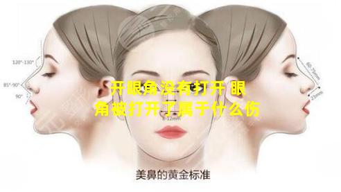 开眼角没有打开 眼角被打开了属于什么伤
